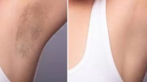 Tampil Cantik dan Percaya Diri, Rahasia Tangan dan Ketiak Cerah Ala Selebriti