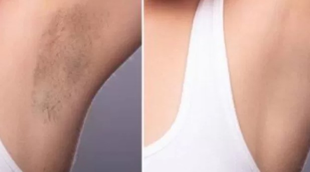 Tampil Cantik dan Percaya Diri, Rahasia Tangan dan Ketiak Cerah Ala Selebriti