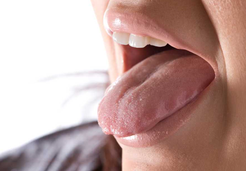 Mengapa Mulut Terasa Asam dan Bagaimana Cara Mengatasinya